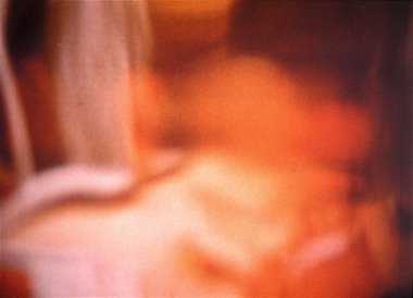 scenesfromunderchildhood
